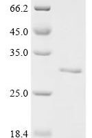 Salmo salar Prolactin (prl) Recombinant Protein - BioCrest Sci