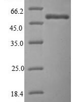 Human Dual specificity protein kinase CLK2 (CLK2), partial Recombinant Protein - BioCrest Sci