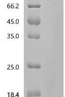 Human Glucocorticoid receptor (NR3C1), partial Recombinant Protein, C-10His-HSA - BioCrest Sci