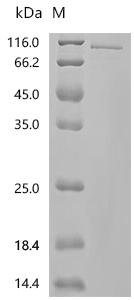 Human Glucocorticoid receptor (NR3C1), partial Recombinant Protein, C-10His-HSA, Homo sapiens (Human), Mammalian cell, C-terminal 10xHis-HSA-tagged, 99.3 kDa, purity >≥ 95% as determined by SDS-PAGE.