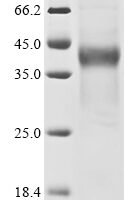 Human Short transient receptor potential channel 6 (TRPC6), partial Recombinant Protein - BioCrest Sci