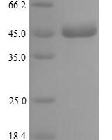 Human Stromelysin-2 (MMP10) Recombinant Protein, N-His, aa 99–476, Yeast - BioCrest Sci