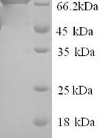 Human Poly (A)-specific ribonuclease PARN (PARN) Recombinant Protein - BioCrest Sci