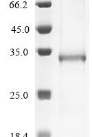 Human Muscarinic acetylcholine receptor M3 (CHRM3), partial Recombinant Protein, N-10His - BioCrest Sci