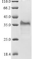 Mouse Epithelial cell adhesion molecule (Epcam), partial Recombinant Protein, C-Myc - BioCrest Sci
