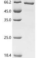 Mouse Tryptophan--tRNA ligase, cytoplasmic (Wars1) Recombinant Protein - BioCrest Sci