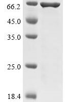 Enterobacteria phage T4 Recombination protein uvsY (uvsY),Biotinylated Recombinant Protein - BioCrest Sci