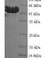 Clostridium botulinum D phage Botulinum neurotoxin type D (botD), partial Recombinant Protein - BioCrest Sci