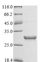 Reovirus type 3 Outer capsid protein lambda-2 (L2), partial Recombinant Protein, N-10His/C-Myc - BioCrest Sci