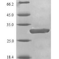 Human Breast cancer type 1 susceptibility protein (BRCA1), partial Recombinant Protein - BioCrest Sci