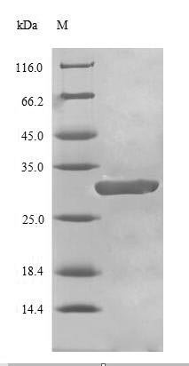 Human Breast cancer type 1 susceptibility protein (BRCA1), partial Recombinant Protein, Homo sapiens (Human), E.coli, N-terminal 6xHis-tagged, 30.2 kDa, purity >≥ 90% as determined by SDS-PAGE.
