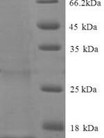 Human BEN domain-containing protein 3 (BEND3), partial Recombinant Protein, N-His - BioCrest Sci