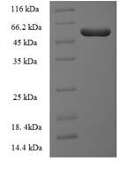 Human Integrin-linked kinase-associated serine/threonine phosphatase 2C (ILKAP) Recombinant Protein - BioCrest Sci