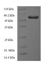 Human Integrin-linked kinase-associated serine/threonine phosphatase 2C (ILKAP) Recombinant Protein, Homo sapiens (Human), E.coli, N-terminal 6xHis-SUMO-tagged, 58.9 kDa, purity >≥ 90% as determined by SDS-PAGE.
