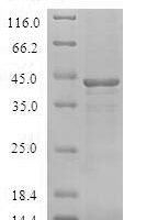 Human Bcl-2-like protein 15 (BCL2L15) Recombinant Protein - BioCrest Sci