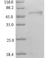 Human Transcriptional adapter 3 (TADA3), partial Recombinant Protein - BioCrest Sci