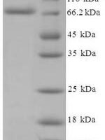 Human Cholesterol side-chain cleavage enzyme, mitochondrial (CYP11A1) Recombinant Protein - BioCrest Sci