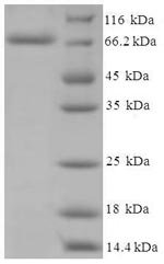 Human Cholesterol side-chain cleavage enzyme, mitochondrial (CYP11A1) Recombinant Protein, Homo sapiens (Human), E.coli, N-terminal 6xHis-SUMO-tagged, 72.1 kDa, purity >≥ 90% as determined by SDS-PAGE.