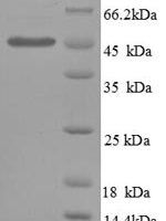 Human Plasminogen activator inhibitor 1 (SERPINE1), partial Recombinant Protein, N-His - BioCrest Sci