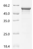 Human Casein kinase I isoform delta (CSNK1D) Recombinant Protein, C-His - BioCrest Sci