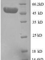 Human Proteasome activator complex subunit 3 (PSME3), partial Recombinant Protein - BioCrest Sci