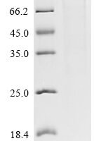 Human Leucine-rich repeat-containing G-protein coupled receptor 5 (LGR5), partial Recombinant Protein, C-hFc1, aa 22–560 - BioCrest Sci