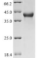 Human SPARC-related modular calcium-binding protein 1 (SMOC1),Partial Recombinant Protein - BioCrest Sci