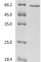 Enterobacteria phage T4 Major capsid protein (gp23) Recombinant Protein - BioCrest Sci