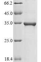 Vaccinia virus Cell surface-binding protein OPG105 (OPG105), partial Recombinant Protein - BioCrest Sci