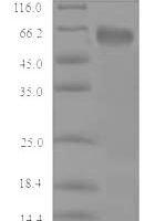 Mouse Cystathionine beta-synthase (Cbs) Recombinant Protein, N-His - BioCrest Sci