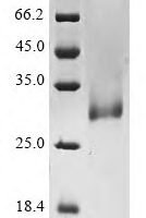 Human Tumor necrosis factor ligand superfamily member 11 (TNFSF11), partial Recombinant Protein - BioCrest Sci