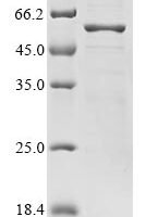 Bat coronavirus HKU3 Nucleoprotein2 (N) Recombinant Protein, C-His, aa 1–421, MW 48.7 kDa - BioCrest Sci