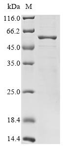 Bat coronavirus HKU3 Nucleoprotein2 (N) Recombinant Protein, C-His, aa 1–421, MW 48.7 kDa, Bat coronavirus HKU3 (BtCoV) (SARS-like coronavirus HKU3), Baculovirus, C-terminal 6xHis-tagged, 48.7 kDa, purity >≥ 85% as determined by SDS-PAGE.