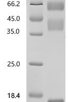 Mouse Transforming growth factor beta-1 proprotein (Tgfb1), Biotinylated Recombinant Protein - BioCrest Sci