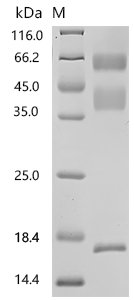 Mouse Transforming growth factor beta-1 proprotein (Tgfb1), Biotinylated Recombinant Protein, Mus musculus (Mouse), Mammalian cell, C-terminal 10xHis-Avi-tagged, 44.8 kDa, purity >≥ 95% as determined by SDS-PAGE.