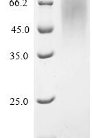 Mouse Transmembrane protease serine 2 (Tmprss2), partial Recombinant Protein, C-His - BioCrest Sci