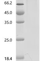 Mouse Secreted Ly-6/uPAR domain-containing protein 2（Slurp2） Recombinant Protein - BioCrest Sci