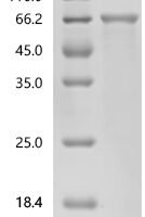 Human EH domain-containing protein 1 (EHD1) Recombinant Protein - BioCrest Sci
