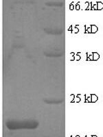 Drosophila melanogaster Bursicon (burs) Recombinant Protein, N-His - BioCrest Sci