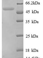 Chicken Tubulin beta-1 chain, partial Recombinant Protein - BioCrest Sci