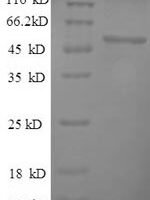 Human Hyaluronidase-1 (HYAL1) Recombinant Protein, N-His, aa 22–435, E.coli - BioCrest Sci