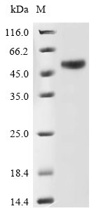Human Galactose-3-O-sulfotransferase 3 (GAL3ST3), partial Recombinant Protein, Homo sapiens (Human), E.coli, N-terminal 10xHis-tagged and C-terminal Myc-tagged, 51.9 kDa, purity >≥ 85% as determined by SDS-PAGE.