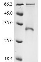 Bovine coronavirus Spike glycoprotein (S), partial Recombinant Protein, C-His, aa 314–634, strain LSU-94LSS-051, E.coli - BioCrest Sci