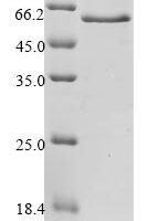Human Spectrin alpha chain, erythrocytic 1 (SPTA1), partial Recombinant Protein, N-10His - BioCrest Sci