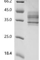 Human Tumor necrosis factor receptor superfamily member 13C (TNFRSF13C)(D26E), partial Recombinant Protein - BioCrest Sci