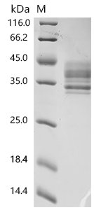 Human Tumor necrosis factor receptor superfamily member 13C (TNFRSF13C)(D26E), partial Recombinant Protein, Homo sapiens (Human), Mammalian cell, C-terminal hFc1-tagged, 36.1 kDa, purity >≥ 95% as determined by SDS-PAGE.