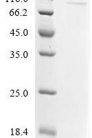 Human Lysyl oxidase homolog 4 (LOXL4) Recombinant Protein, C-His - BioCrest Sci