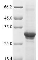 Human Acetylcholine receptor subunit alpha (CHRNA1), partial Recombinant Protein, N-His, aa 21–255 - BioCrest Sci
