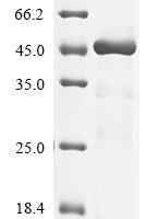 Human Pro-neuregulin-1, membrane-bound isoform (NRG1), partial Recombinant Protein, N-His-GST - BioCrest Sci