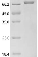 Human Acetylcholinesterase (ACHE) Recombinant Protein, C-10His - BioCrest Sci